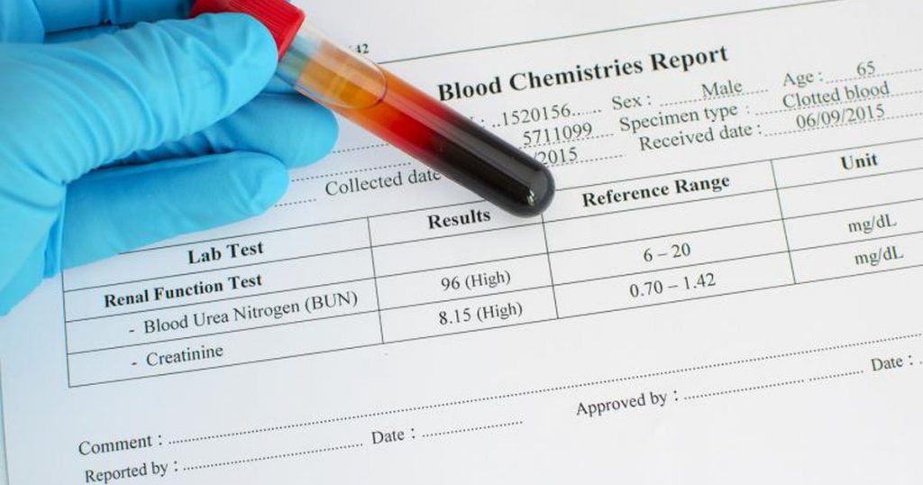 blood-urea-nitrogen-creatinine-ratio-and-interpretations